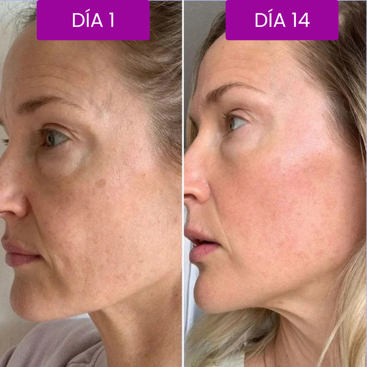 Botóx Solution — Tensa, Hidrata y Rejuvenece