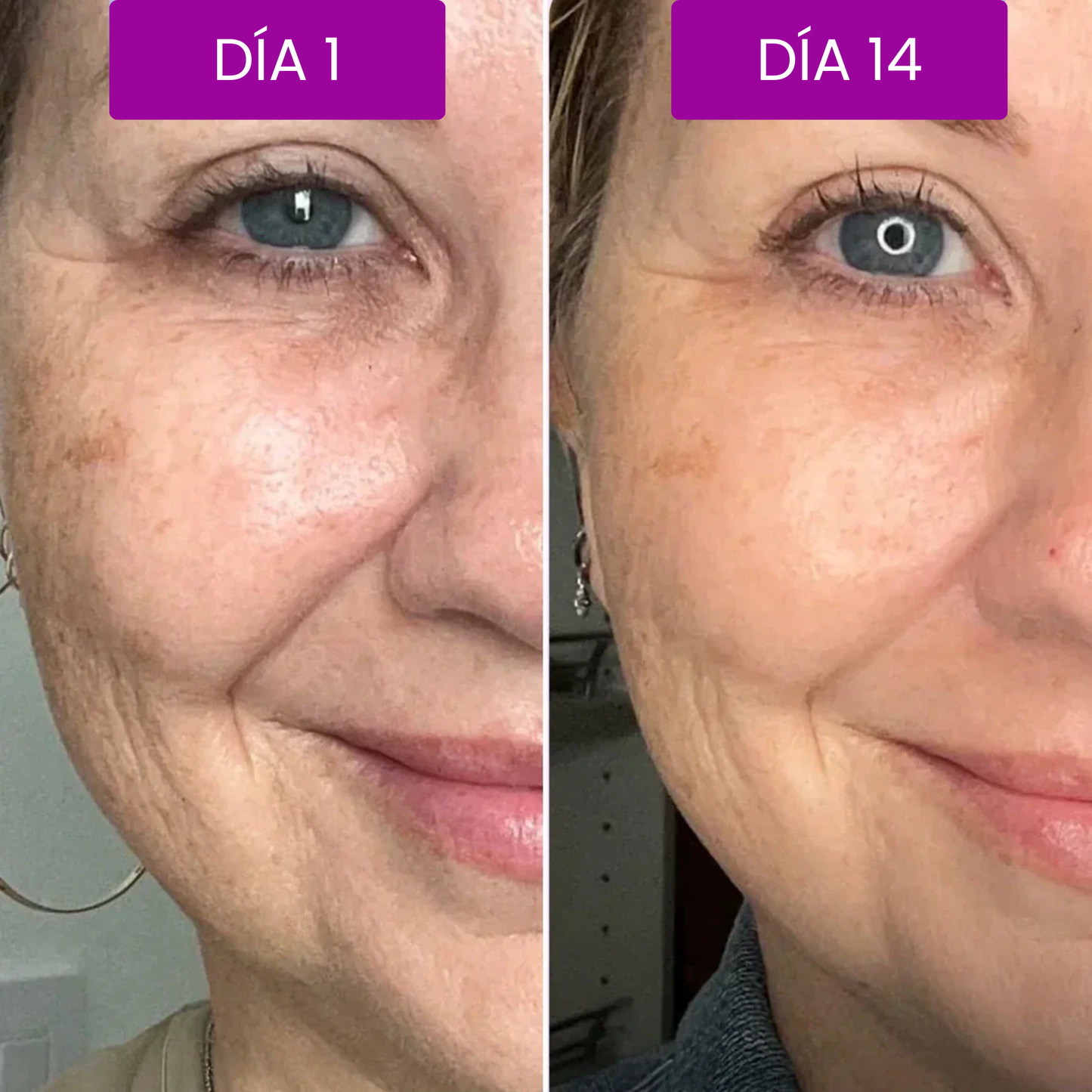 Botóx Solution — Tensa, Hidrata y Rejuvenece
