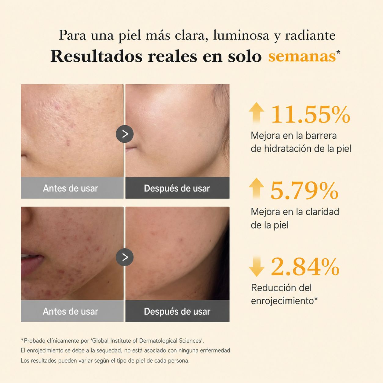 Sérum Coreano Antimanchas Kojic + Turmeric®