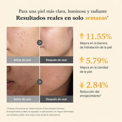 Sérum Coreano Antimanchas Kojic + Turmeric®